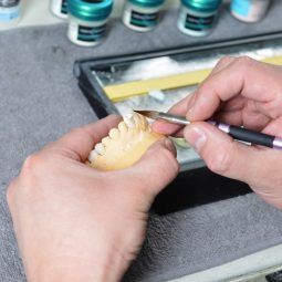 протезирование Кременчуг стоматолог